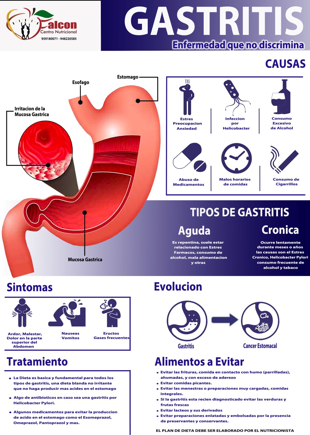 GASTRITIS ES CAUSANTE DE CANCER GASTRICO
